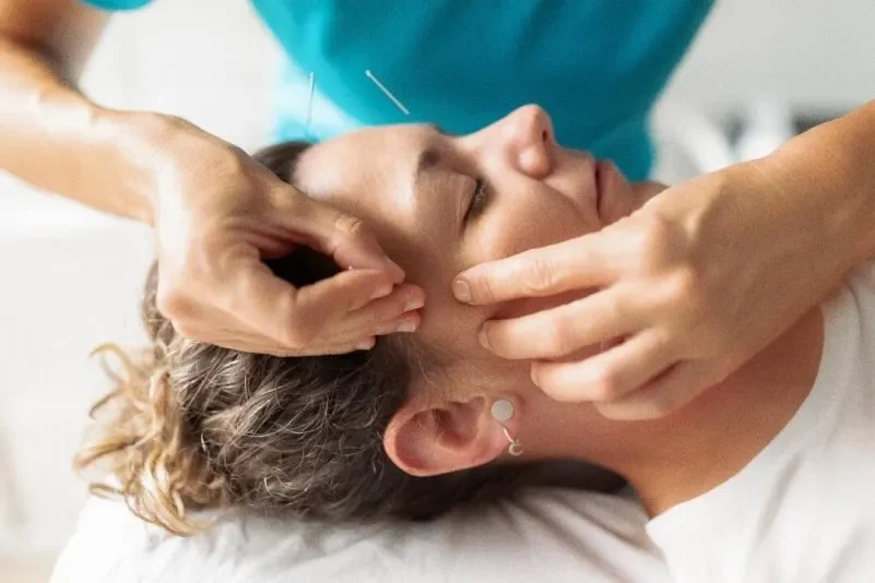 Cómo la acupuntura facial puede ayudar a rejuvenecer su piel
